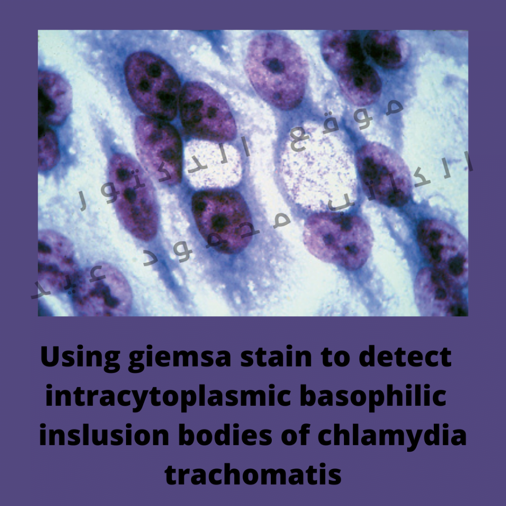 Using giemsa stain to detect  intracytoplasmic basophilic  inslusion bodies of chlamydia trachomatis